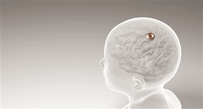 耀世测速：首例脑机接口设备人体移植完成